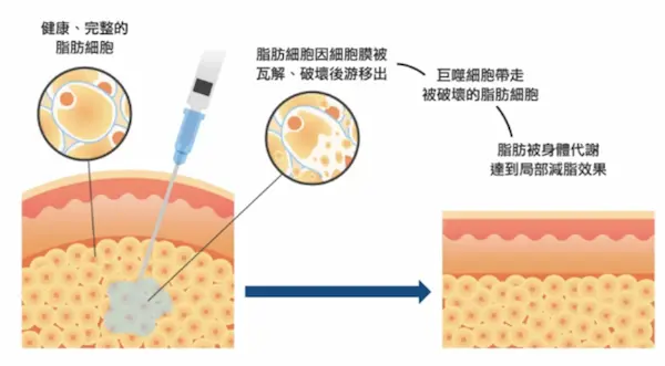 溶脂針8 溶脂針推薦8