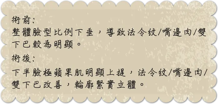 Doublo倍提音波拉提 Doublo倍提音波拉提|少女針價格,奇蹟針,台北醫美推薦,雷射除毛